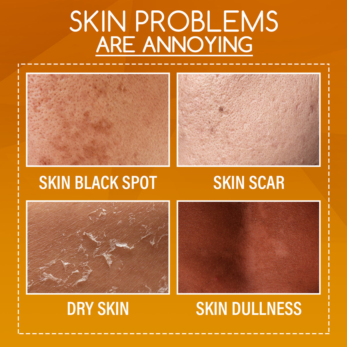 Four close-up panels show skin conditions labeled black spot, scar, dry skin, and dullness against an orange background.