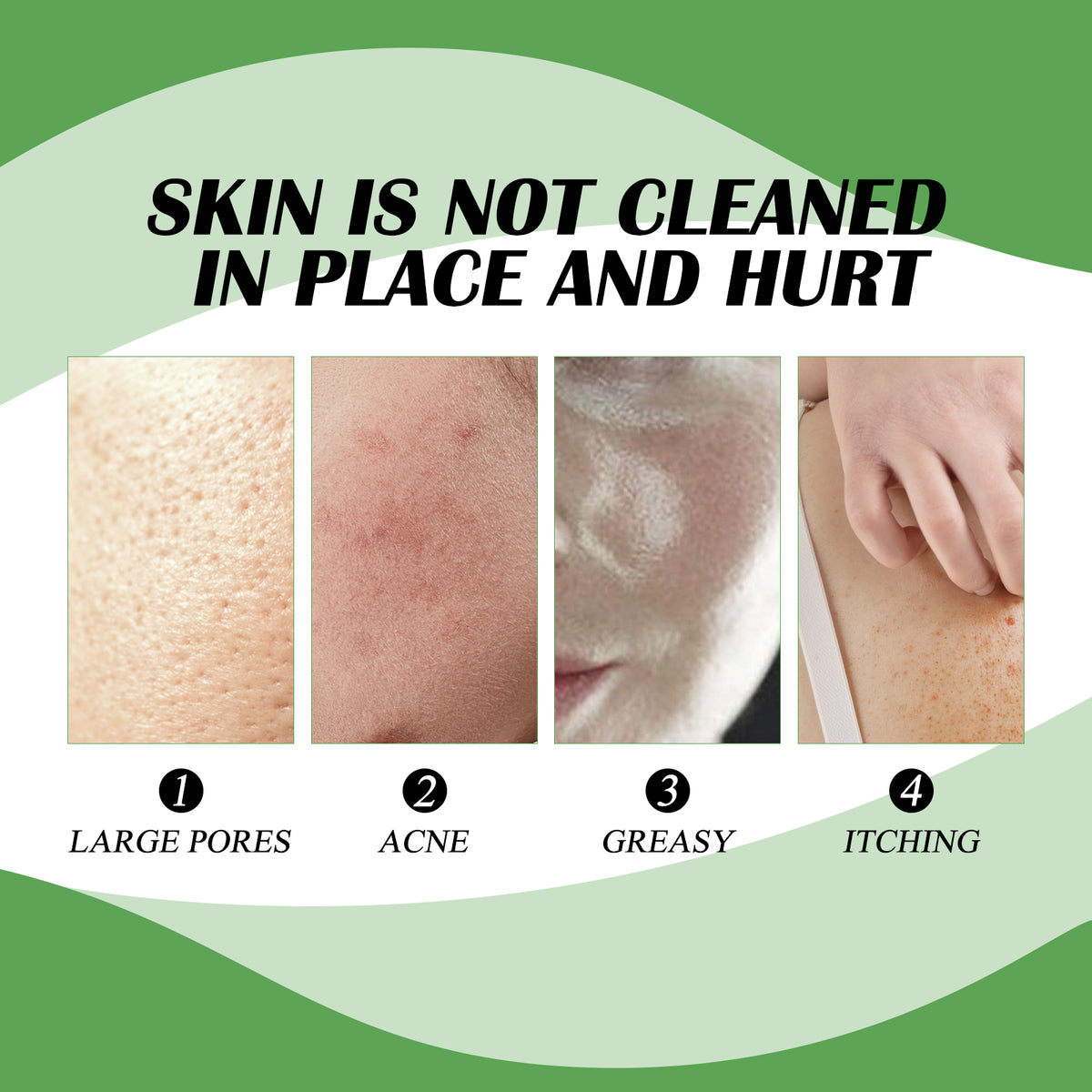 Four skin condition examples: large pores, acne, greasy face, and itching skin, with numbered labels 1 to 4.
