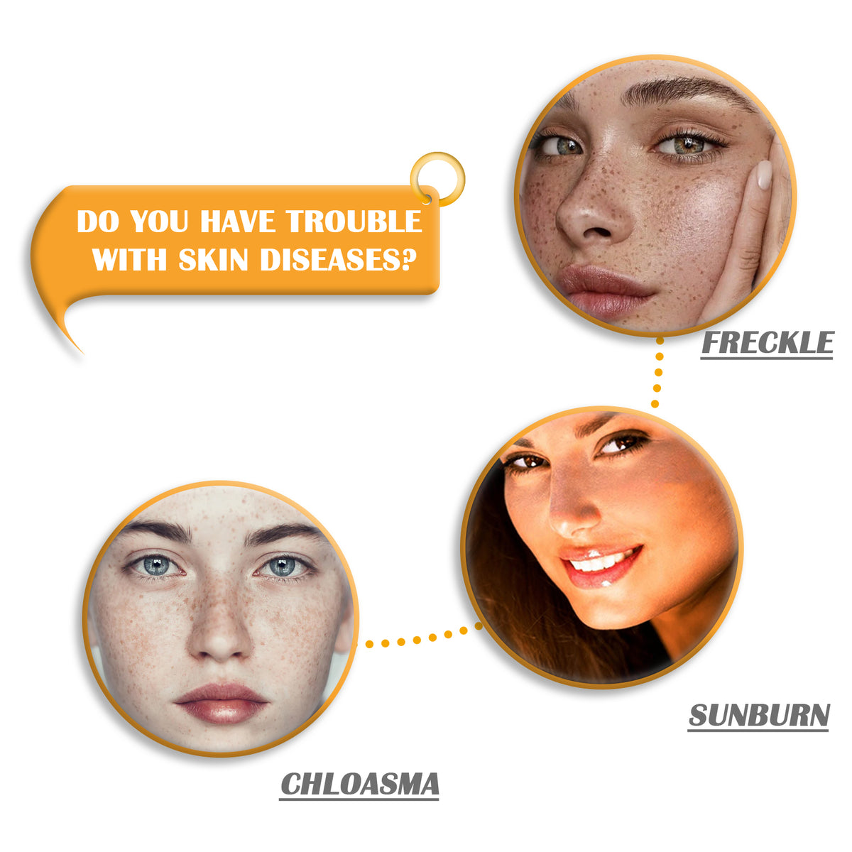 Text "DO YOU HAVE TROUBLE WITH SKIN DISEASES?" and round panels labeled Freckle, Chloasma, and Sunburn showing skin.